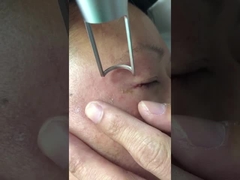 دستگاه لیزر پیکوثانیه 450ps 1064 نانومتری 532 نانومتری Q Switched Nd Yag