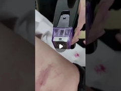 دستگاه میکرونیدل 50 ولت RF 100 ولت تا 240 ولت