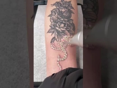 دستگاه لیزر پیکوثانیه 450ps 1064 نانومتری 532 نانومتری Q Switched Nd Yag