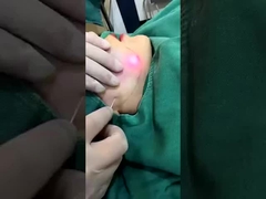 دستگاه کاهش چربی لیزر دیود 1470nm حرفه ای نتایج قابل مشاهده در 2-3 جلسه